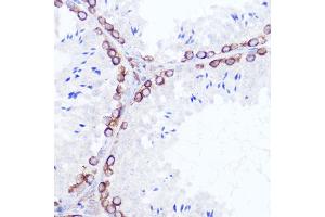 Immunohistochemistry of paraffin-embedded rat testis using SSR2 Rabbit pAb (ABIN7270299) at dilution of 1:100 (40x lens).