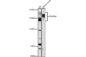 Western blot analysis of extracts of various cell lines, using PDGFRA antibody (ABIN3022920, ABIN3022921, ABIN3022922 and ABIN6219298) at 1:1000 dilution.