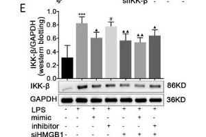 Effects of paeonol on IKK-β in LPS-induced RAW264.