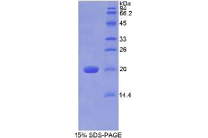 SDS-PAGE (SDS) image for Galactosylceramidase (GALC) (AA 375-535) protein (His tag) (ABIN1099091)