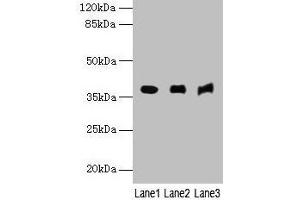 Western blot All lanes: MRNIP antibody at 4 μg/mL Lane 1: Mouse kidney tissue Lane 2: Mouse heart tissue Lane 3: Hela whole cell lysate Secondary Goat polyclonal to rabbit IgG at 1/10000 dilution Predicted band size: 38, 30, 32 kDa Observed band size: 38 kDa (MRN Complex-Interacting Protein (MRNIP) (AA 1-200) anticorps)