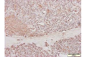 anti-Cardiotin antibody