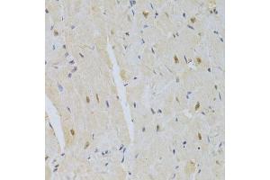 Immunohistochemistry of paraffin-embedded mouse heart using SNRPA Antibody. (SNRPA1 anticorps  (AA 1-282))