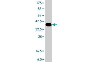 Western Blot detection against Immunogen (37.