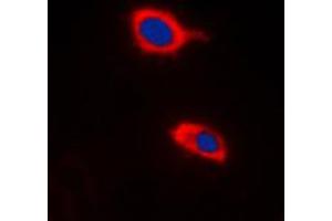 Immunofluorescent analysis of HCCS staining in Raw264.
