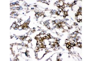 IHC analysis of AEBP2 using anti-AEBP2 antibody (ABIN4886435). (AEBP2 anticorps  (AA 424-517))