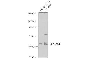 Western blot analysis of extracts of various cell lines, using SLC37 antibody (ABIN7270453) at 1:3000 dilution. (SLC37A4 anticorps  (C-Term))