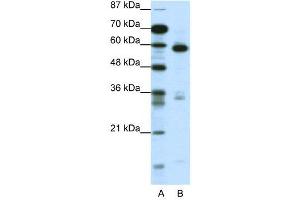 WB Suggested Anti-MBD1  Antibody Titration: 1. (MBD1 anticorps  (C-Term))
