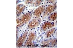 SD9 Antibody (C-term) (ABIN651896 and ABIN2840442) immunohistochemistry analysis in formalin fixed and paraffin embedded human stomach tissue followed by peroxidase conjugation of the secondary antibody and DAB staining. (SAMD9 anticorps  (C-Term))