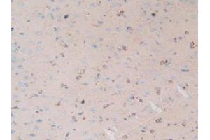 Figure. (MAP4 anticorps  (AA 2-250))