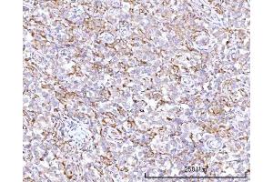 IHC analysis of RPN1 using anti-RPN1 antibody (ABIN7600447). (RPN1 anticorps  (AA 196-495))