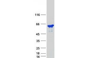 Validation with Western Blot