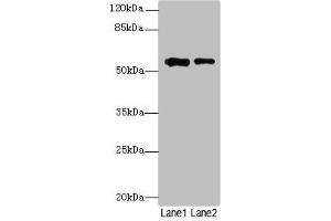 Western blot All lanes: WDR34 antibody at 1. (WDR34 anticorps  (AA 1-210))
