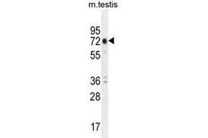 ANKRD5 Antibody (C-term) western blot analysis in mouse testis tissue lysates (35µg/lane). (ANKRD5 anticorps  (C-Term))