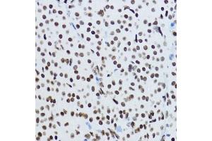 Immunohistochemistry of paraffin-embedded rat ovary using Acetyl-Histone H3-K9 antibody (ABIN7267675) at dilution of 1:200 (40x lens).