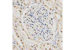 Immunohistochemistry (IHC) image for anti-Small Nuclear Ribonucleoprotein Polypeptide E (SNRPE) antibody (ABIN1876676) (SNRPE anticorps)