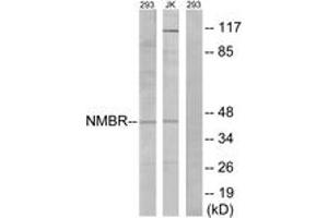 Western blot analysis of extracts from 293/Jurkat cells, using NMBR Antibody. (NMBR anticorps  (AA 221-270))
