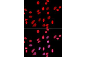 Immunofluorescence (IF) image for anti-Hepatoma-Derived Growth Factor (HDGF) antibody (ABIN1876535) (HDGF anticorps)