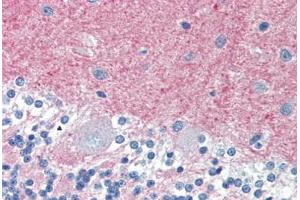 Human Brain, Cerebellum (formalin-fixed, paraffin-embedded) stained with THY1 antibody ABIN396935 at 10 ug/ml followed by biotinylated anti-mouse IgG secondary antibody ABIN481714, alkaline phosphatase-streptavidin and chromogen.