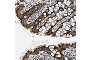 Immunohistochemical staining of human rectum with ZFPL1 polyclonal antibody  shows cytoplasmic positivity with a granular pattern in glandular cells. (ZFPL1 anticorps)