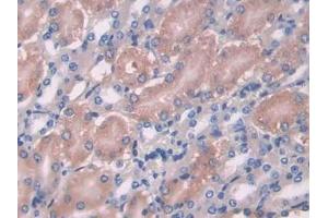 Detection of OPTN in Mouse Kidney Tissue using Polyclonal Antibody to Optineurin (OPTN)