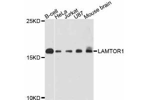 Western blot analysis of extracts of various cell lines, using LAMTOR1 antibody (ABIN5998112) at 1:3000 dilution. (LAMTOR1 anticorps)