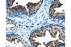 Immunohistochemical staining of paraffin-embedded Kidney tissue using anti-SATB1mouse monoclonal antibody.