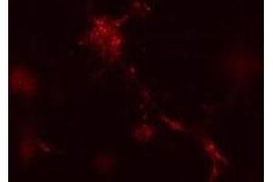 Mouse leukaemic monocyte macrophage cells treated with vinblastine for 1 hr. (ATG12 anticorps  (N-Term))