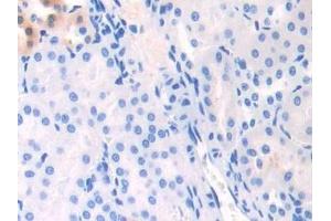 Detection of APOC1 in Mouse Kidney Tissue using Polyclonal Antibody to Apolipoprotein C1 (APOC1)