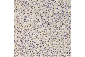Immunohistochemistry of paraffin-embedded human amygdalitis using ANP32A Antibody (ABIN5973390) at dilution of 1/100 (40x lens). (PHAP1 anticorps)