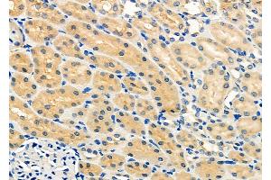 ABIN6259999 and ABIN6272243 at 1/100 staining Rat kidney tissue by IHC-P.