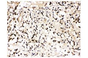 IHC analysis of VCP using anti-VCP antibody (ABIN3043958).