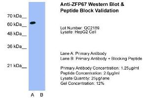 Host:  Rabbit  Target Name:  ZFP67  Sample Type:  HepG2  Lane A:  Primary Antibody  Lane B:  Primary Antibody + Blocking Peptide  Primary Antibody Concentration:  1. (ZBTB7B anticorps  (Middle Region))