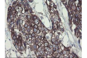 Image no. 4 for anti-Diphthamide Biosynthesis Protein 2 (DPH2) antibody (ABIN1497891)