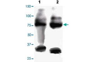 FOXP2 polyclonal antibody  staining of mouse brain (Lane 1) and mouse lung (Lane 2) lysate at 2.