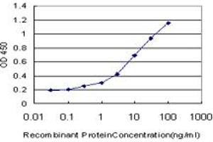 Detection limit for recombinant GST tagged IRAK3 is approximately 0. (IRAK3 anticorps  (AA 497-596))