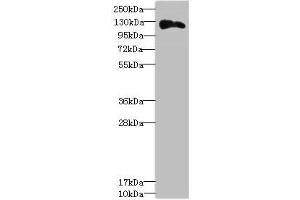Western blot All lanes: ANLNantibody at 3. (Anillin anticorps  (AA 845-1124))