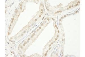 anti-Tripartite Motif Containing 33 (TRIM33) (C-Term) antibody