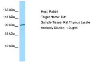 Image no. 1 for anti-Terminal Uridylyl Transferase 1, U6 SnRNA-Specific (TUT1) (N-Term) antibody (ABIN6749859) (TUT1 anticorps  (N-Term))