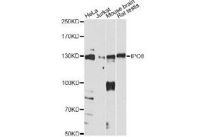 Western blot analysis of extracts of various cell lines, using IPO8 antibody. (Importin 8 anticorps)