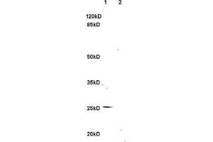 L1 rat brain, L2 rat kidney lysates probed (ABIN740625) at 1:200 in 4 °C.