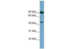 WB Suggested Anti-DGKA Antibody Titration: 0. (DGKA anticorps  (N-Term))