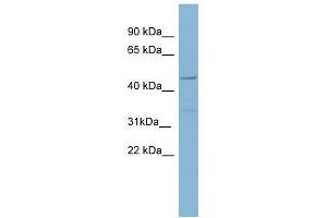 Matrilin 1 antibody used at 1 ug/ml to detect target protein. (MATN1 anticorps  (Middle Region))