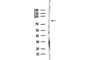 anti-Stonin 1 (STON1) (C-Term) antibody
