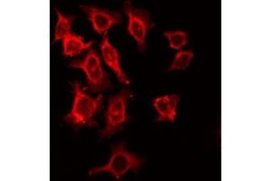 ABIN6266484 staining HeLa by IF/ICC. (IL2 Receptor beta anticorps  (Internal Region))