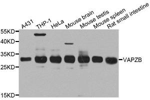 Western blot analysis of extracts of various cell lines, using CAPZB antibody. (CAPZB anticorps  (AA 1-272))