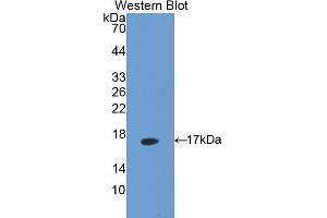 Western Blotting (WB) image for anti-Mitochondrially Encoded NADH Dehydrogenase 5 (MT-ND5) (AA 425-562) antibody (ABIN1171876)