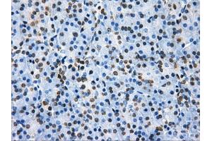 Immunohistochemical staining of paraffin-embedded colon tissue using anti-HDAC10mouse monoclonal antibody. (HDAC10 anticorps)
