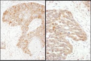 Immunohistochemistry (IHC) image for anti-TS (C-Term) antibody (ABIN7795593) (TS (C-Term) anticorps)