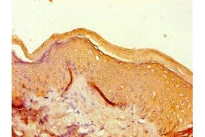 Immunohistochemistry of paraffin-embedded human skin tissue using ABIN7152936 at dilution of 1:100 (Filaggrin anticorps  (AA 3838-4061))